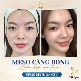 hướng dẫn sử dụng meso căng bóng da
