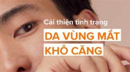hướng dẫn sử dụng mí mắt bị khô bong da