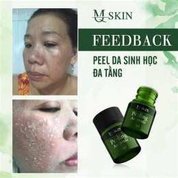 hướng dẫn sử dụng peel bong da