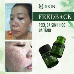 hướng dẫn sử dụng peel da bong