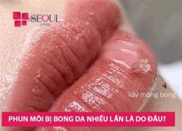 hướng dẫn sử dụng phun môi bị bong da nhiều lần