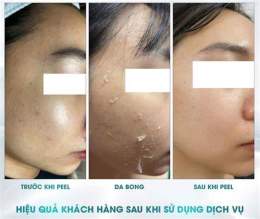 hướng dẫn sử dụng tại sao tái tạo da không bong