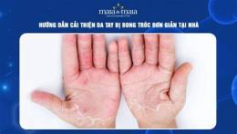 hướng dẫn sử dụng tay bị bong da nhiều