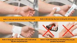 hướng dẫn sử dụng xử lý vết bỏng bị tróc da