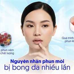 phun môi bị bong da nhiều lần