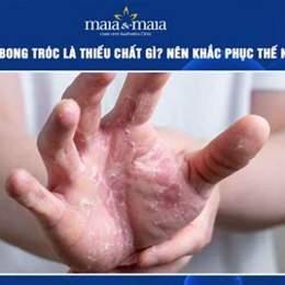 tay bong da là thiếu chất gì