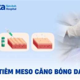 tiêm meso căng bóng da giá bao nhiêu