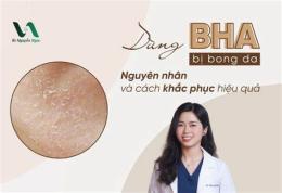 tính năng nổi bật bị bong da