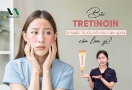 tính năng nổi bật bôi tretinoin bị bong da trong bao lâu