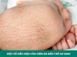 tính năng nổi bật bong da ở trẻ sơ sinh