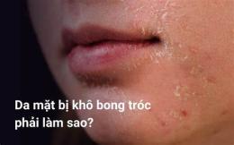 tính năng nổi bật da đầu khô bong tróc