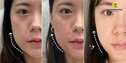 tính năng nổi bật da mặt căng bóng