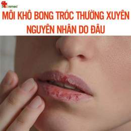 tính năng nổi bật da quanh miệng bị khô bong tróc