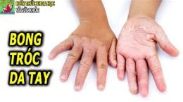 tính năng nổi bật da tay bị khô bong tróc phải làm sao