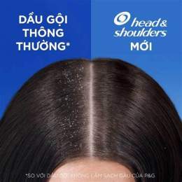 tính năng nổi bật dầu gội cho da đầu khô bong tróc