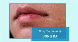 tính năng nổi bật dùng tretinoin bị bong da bao lâu