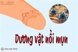 tính năng nổi bật dương vật bị khô và bong da