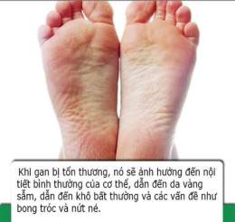 tính năng nổi bật lòng bàn chân bị bong da