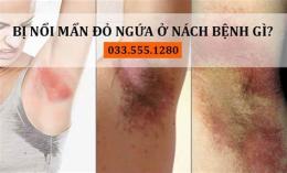 tính năng nổi bật nách bị ngứa và bong da