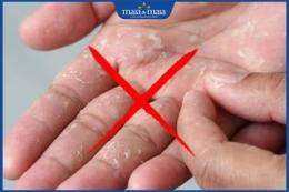 tính năng nổi bật tay bị bong da phải làm sao