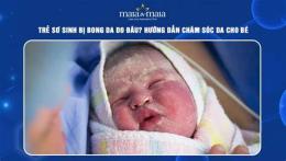 tính năng nổi bật trẻ sơ sinh bị bong da