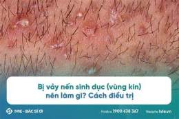 tính năng nổi bật vùng kín bị khô bong da có sao không
