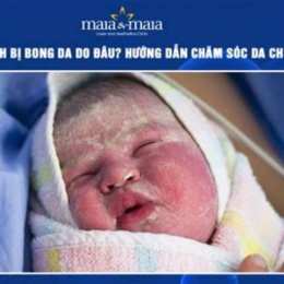 trẻ sơ sinh bị bong da có sao không