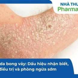 viêm da bong vảy
