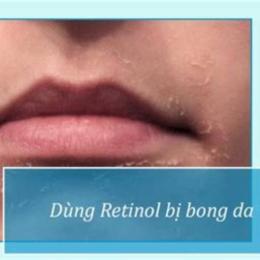 xài retinol bị bong da